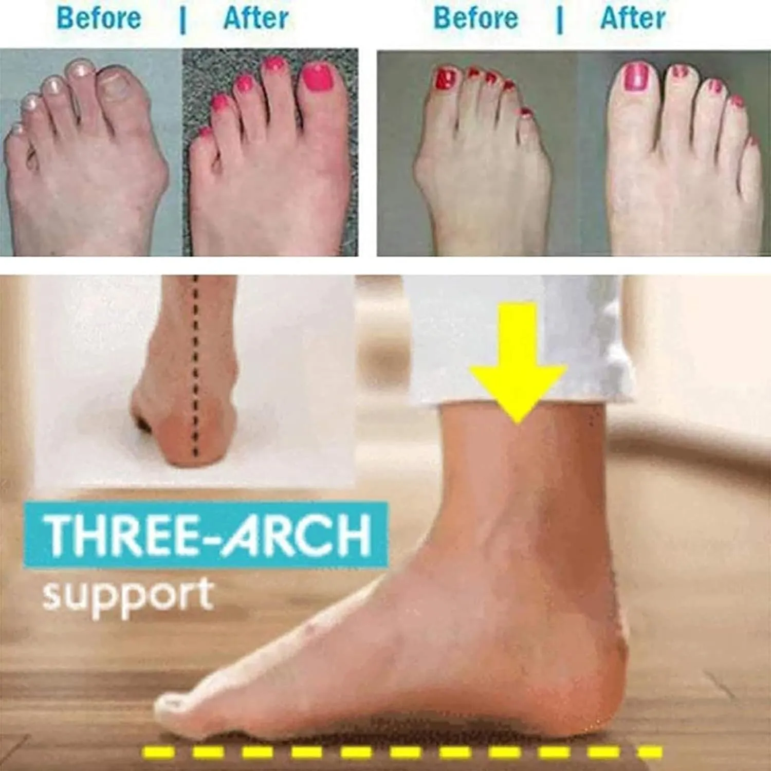 Women's Bunion Corrector Slide Sandals,Foot Hallux Valgus Correction Beach Slippers,Stylish Outdoor Plantar Fasciitis Slippers
