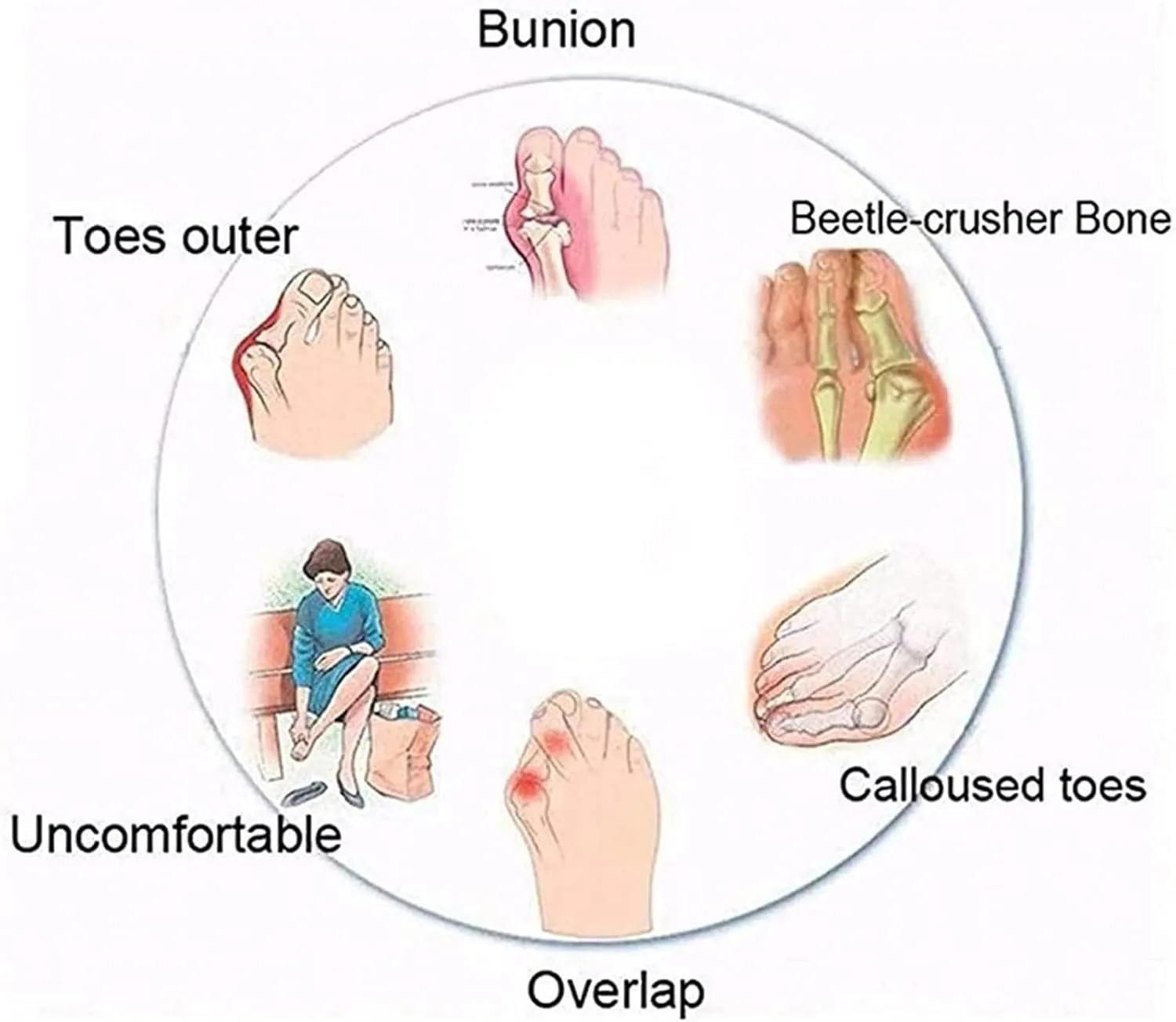 Women's Bunion Corrector Slide Sandals,Foot Hallux Valgus Correction Beach Slippers,Stylish Outdoor Plantar Fasciitis Slippers